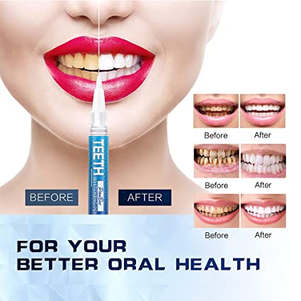 Instant Teeth Whitening Pen
